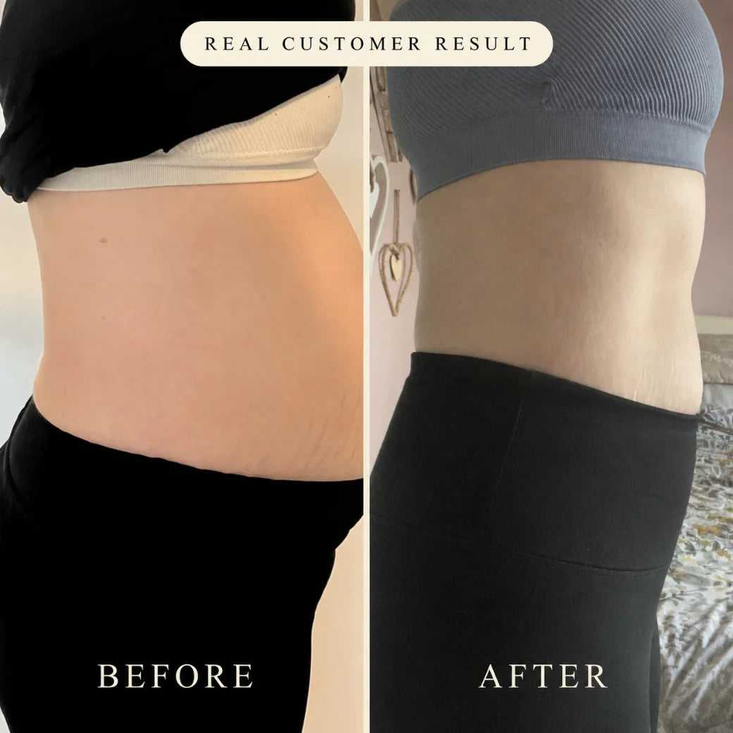 Before / after