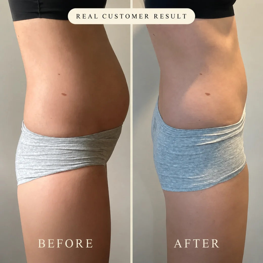 Before / after