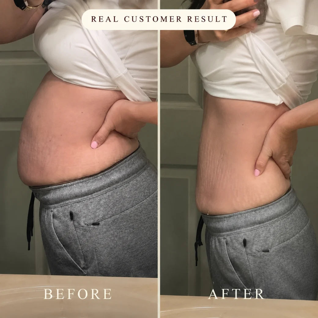 Before / after